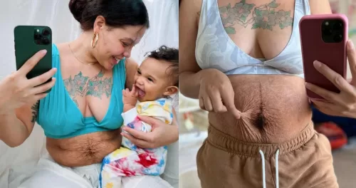WOMAN Shows the Raw Truth of Postpartum Bodies